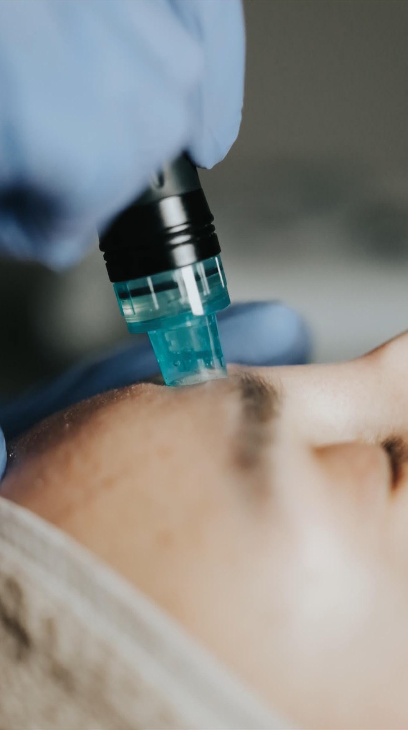 Uşak Merkez’deki Seba Güzellik Merkezi’nde alın bölgesi için özel olarak uygulanan Hydrafacial bakım hizmeti sunuyoruz Alın bölgesi için hydrafacial görseli